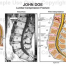 Compression Fracture